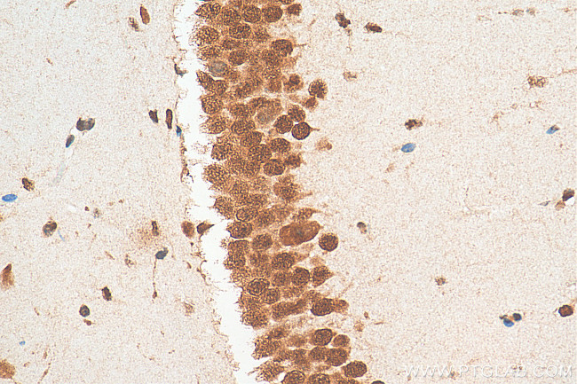 ELAVL4 Antibody in Immunohistochemistry (Paraffin) (IHC (P))