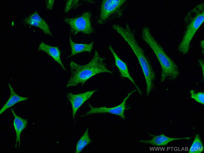 CIP2A Antibody in Immunocytochemistry (ICC/IF)