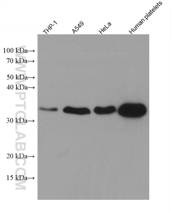 MGLL Antibody in Western Blot (WB)