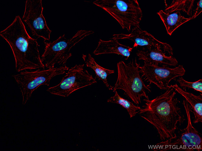 DHX37 Antibody in Immunocytochemistry (ICC/IF)