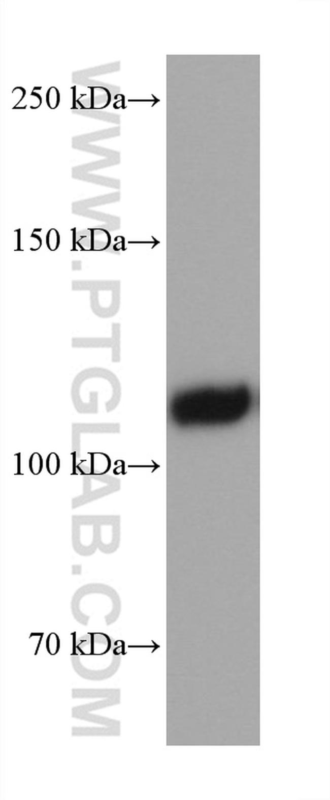 EMCN Antibody in Western Blot (WB)