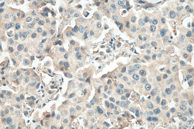 RCHY1 Antibody in Immunohistochemistry (Paraffin) (IHC (P))