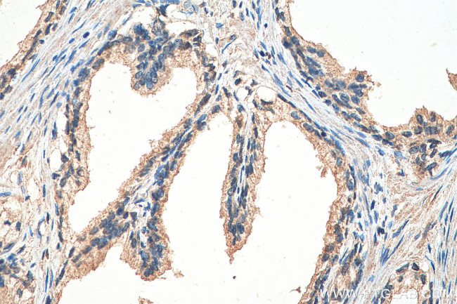GIT2 Antibody in Immunohistochemistry (Paraffin) (IHC (P))
