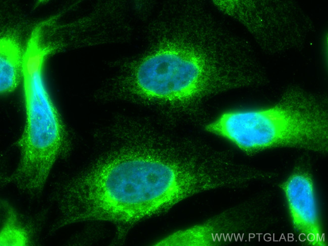 HSP47 Antibody in Immunocytochemistry (ICC/IF)