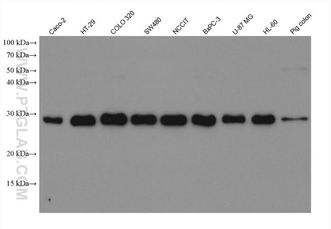 PLEKHB2 Antibody in Western Blot (WB)