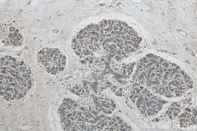 SLC25A36 Antibody in Immunohistochemistry (Paraffin) (IHC (P))