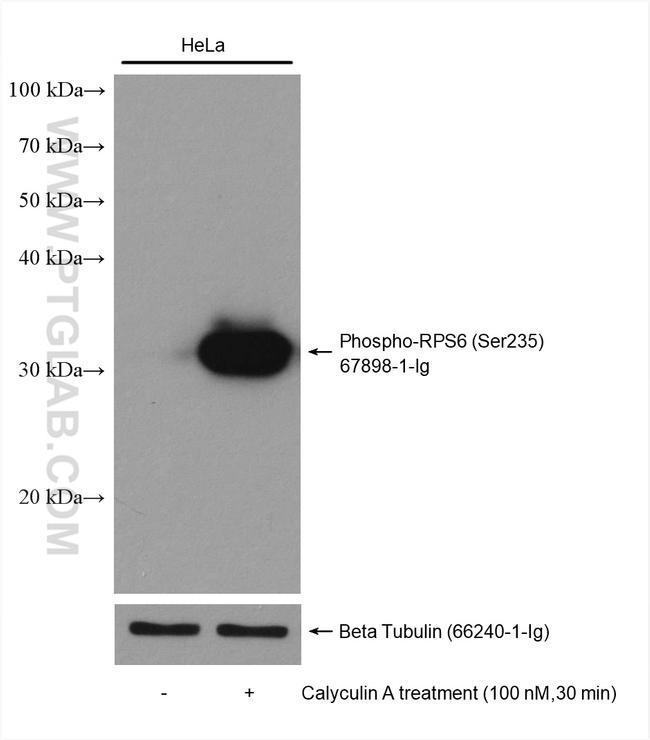 Phospho-RPS6 (Ser235) Antibody in Western Blot (WB)