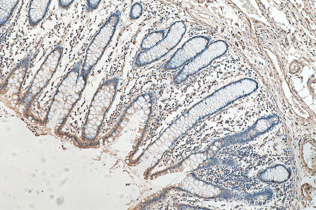 Phospho-P53 (Ser46) Antibody in Immunohistochemistry (Paraffin) (IHC (P))
