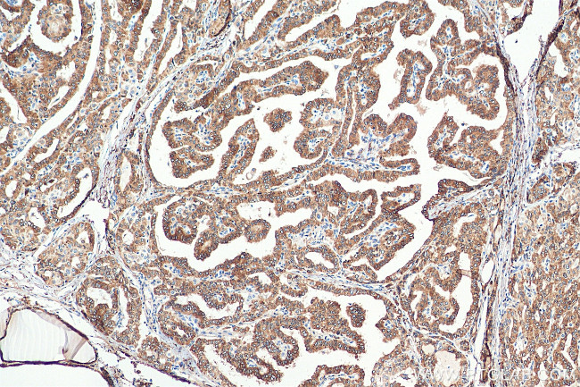 METTL7A Antibody in Immunohistochemistry (Paraffin) (IHC (P))