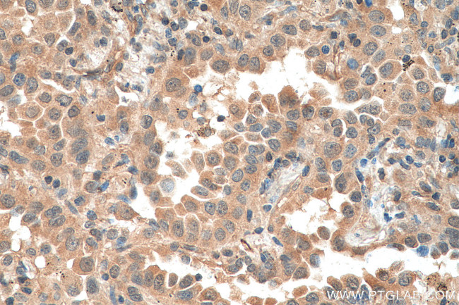 EIF5A2 Antibody in Immunohistochemistry (Paraffin) (IHC (P))