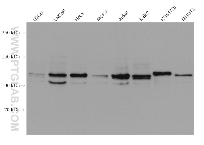 OSBPL5 Antibody in Western Blot (WB)