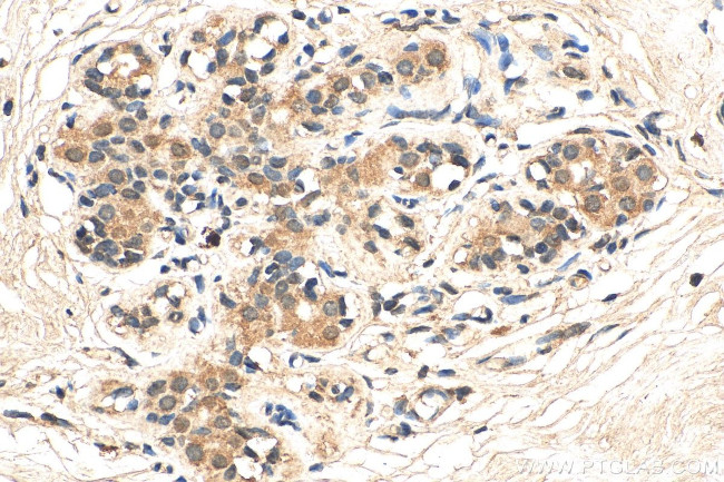 DDX3 Antibody in Immunohistochemistry (Paraffin) (IHC (P))