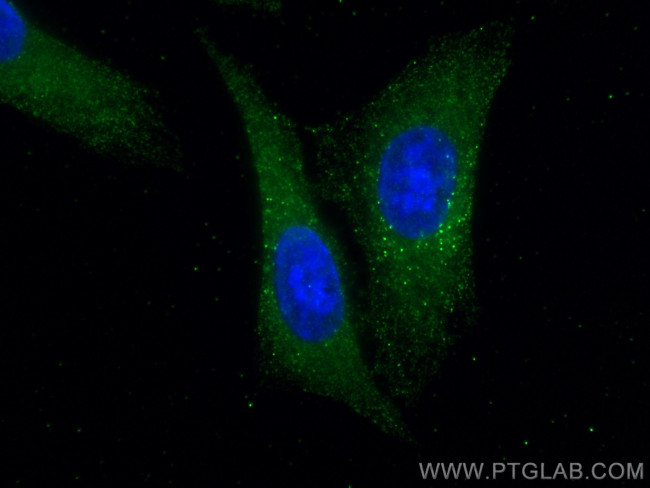 PGD Antibody in Immunocytochemistry (ICC/IF)