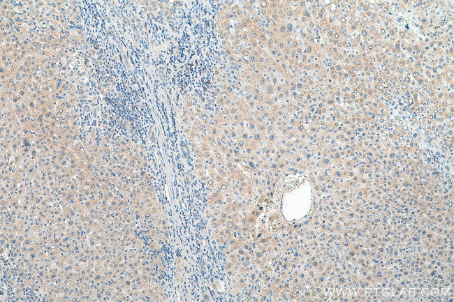 USP10 Antibody in Immunohistochemistry (Paraffin) (IHC (P))