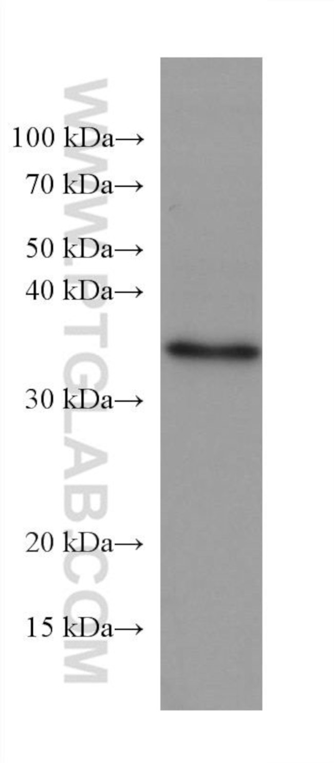 NUDT22 Antibody in Western Blot (WB)
