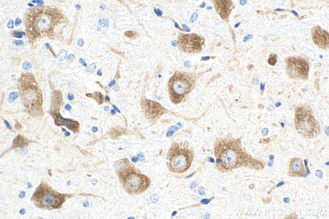 ROBO1 Antibody in Immunohistochemistry (Paraffin) (IHC (P))