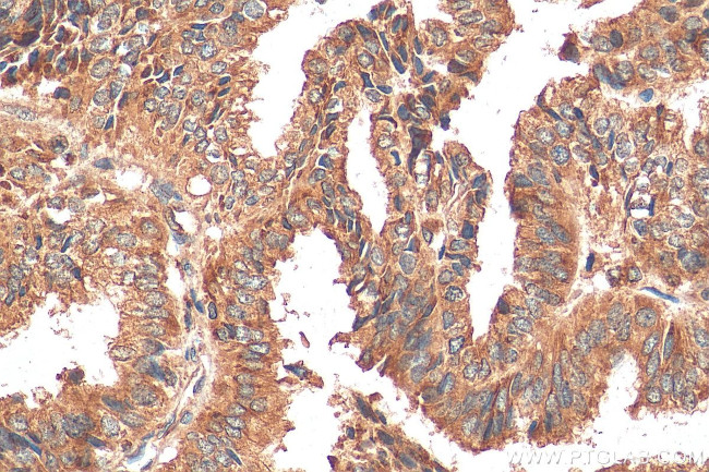 TRAPA/SSR1 Antibody in Immunohistochemistry (Paraffin) (IHC (P))