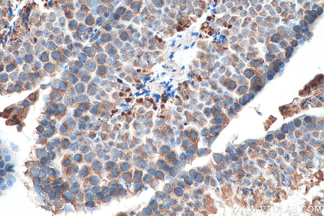 SLC36A3 Antibody in Immunohistochemistry (Paraffin) (IHC (P))
