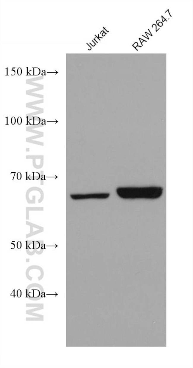 PTPN9 Antibody in Western Blot (WB)