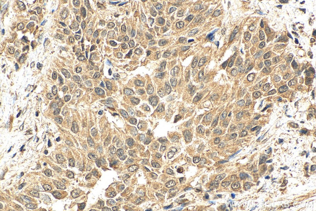 AGO2 Antibody in Immunohistochemistry (Paraffin) (IHC (P))