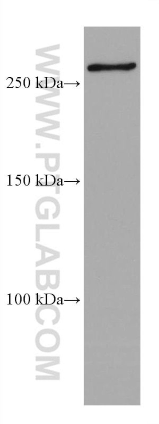 SETD1A Antibody in Western Blot (WB)