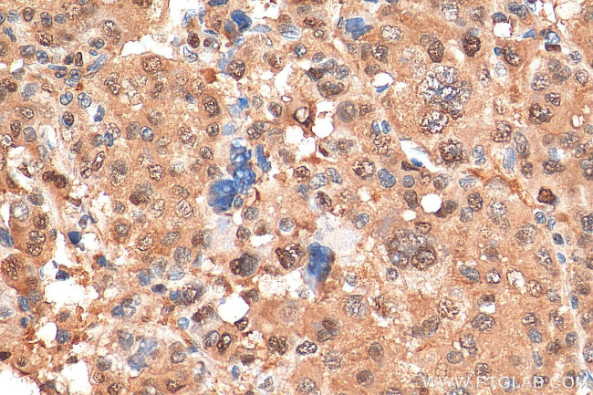 PSMA3 Antibody in Immunohistochemistry (Paraffin) (IHC (P))
