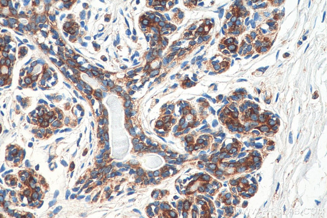 FARSA Antibody in Immunohistochemistry (Paraffin) (IHC (P))