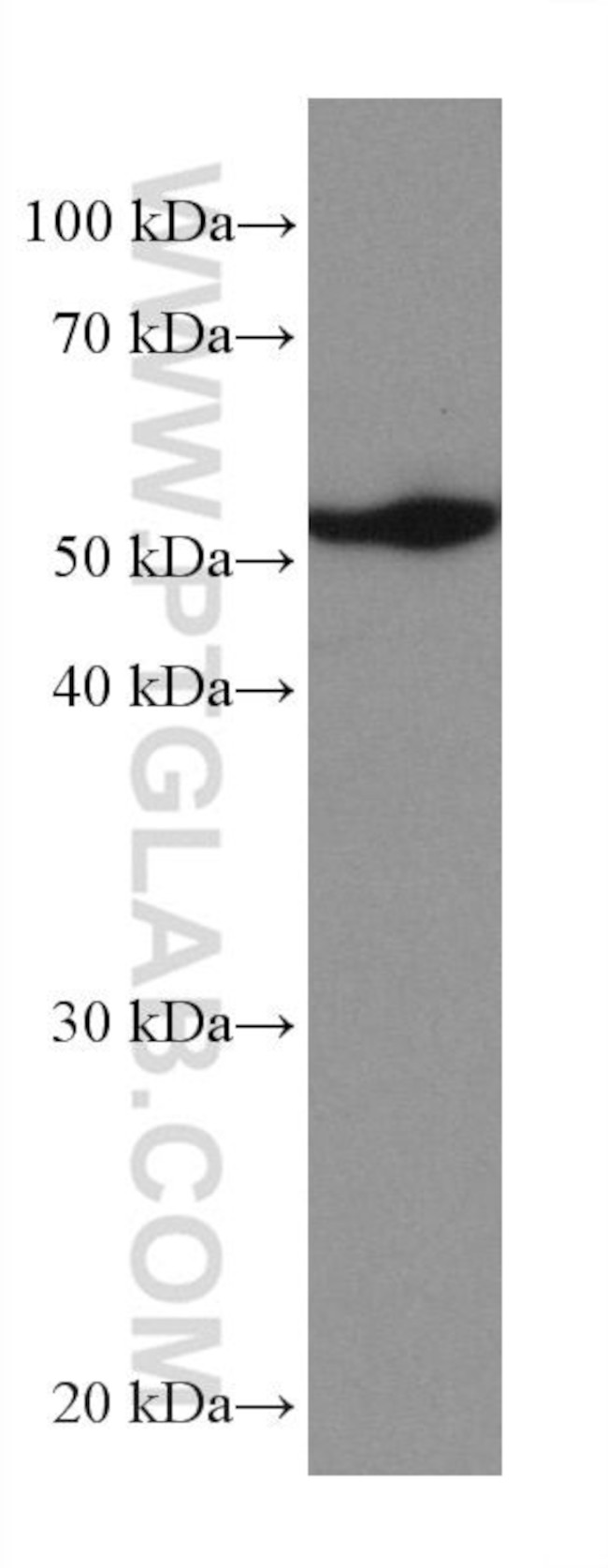 TrpRS Antibody in Western Blot (WB)