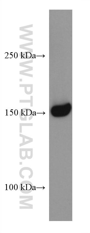 RON/MST1R Antibody in Western Blot (WB)