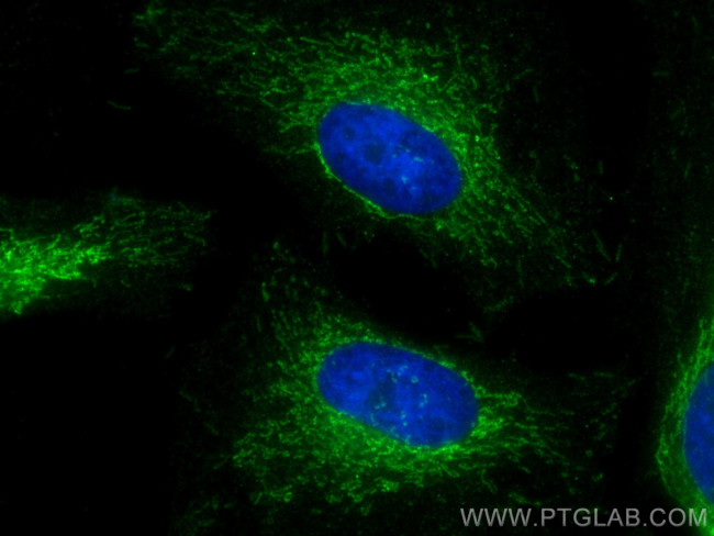 HADHB Antibody in Immunocytochemistry (ICC/IF)