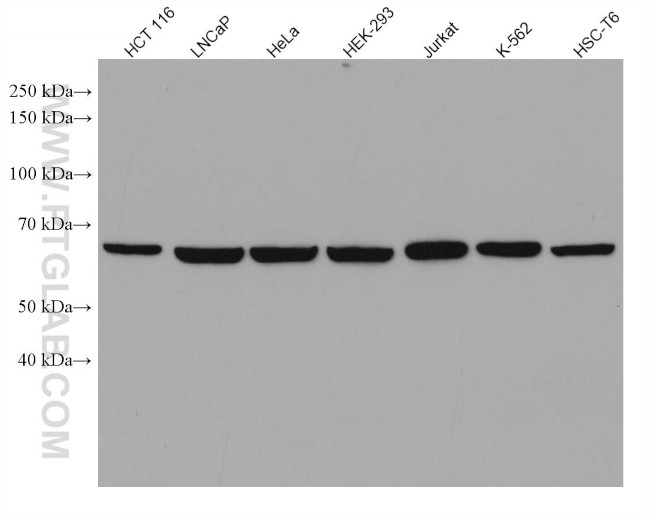 RPA1 Antibody in Western Blot (WB)