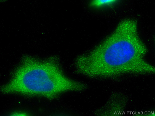 LIMK1 Antibody in Immunocytochemistry (ICC/IF)