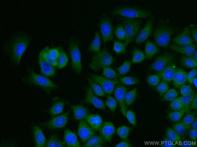 ARHGEF16 Antibody in Immunocytochemistry (ICC/IF)