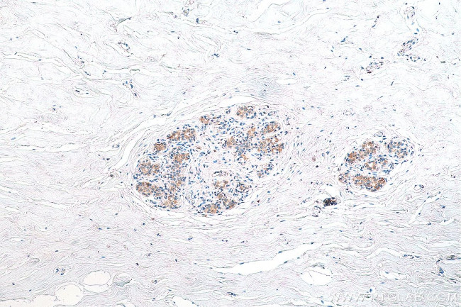 NMT1 Antibody in Immunohistochemistry (Paraffin) (IHC (P))