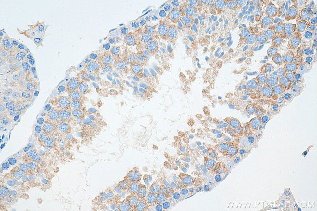 IFT81 Antibody in Immunohistochemistry (Paraffin) (IHC (P))