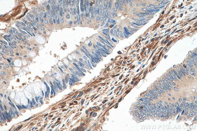 Talin-1 Antibody in Immunohistochemistry (Paraffin) (IHC (P))