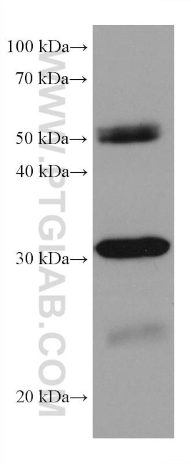 RPA2 Antibody in Western Blot (WB)