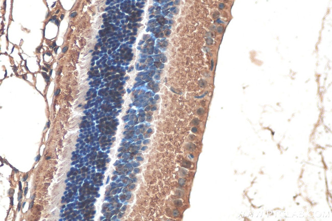 Alpha B Crystallin Antibody in Immunohistochemistry (Paraffin) (IHC (P))