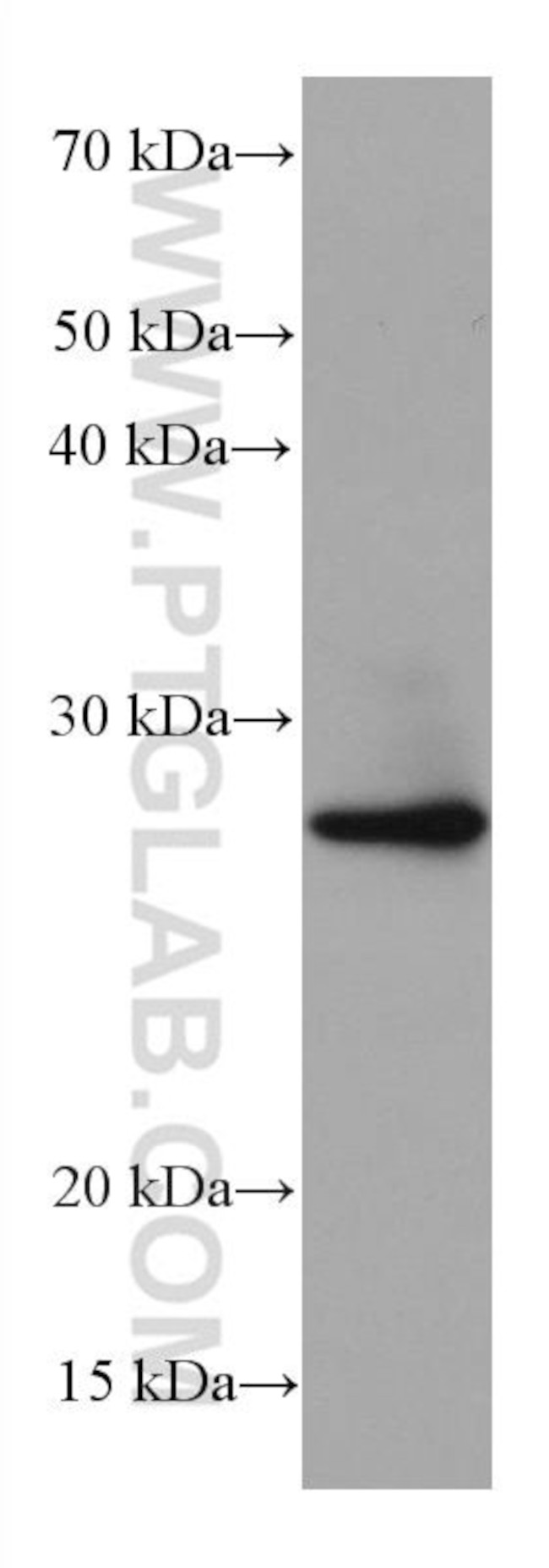BCAS2 Antibody in Western Blot (WB)