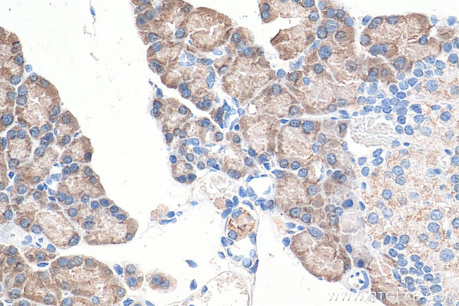 ASNS Antibody in Immunohistochemistry (Paraffin) (IHC (P))