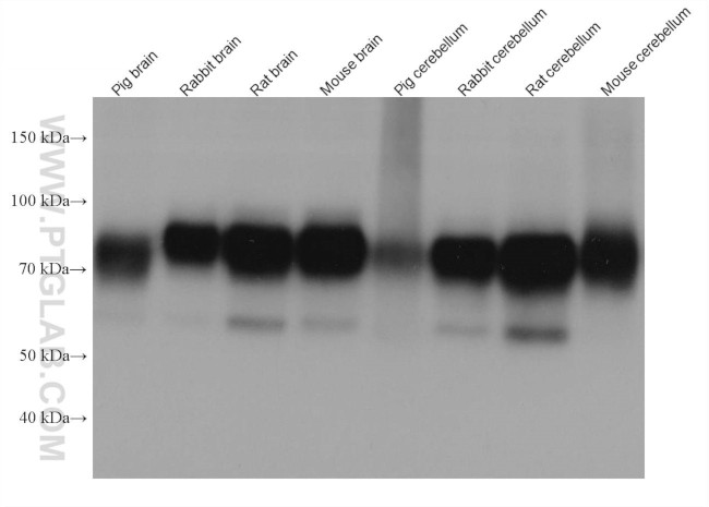 KCNA1 Antibody in Western Blot (WB)
