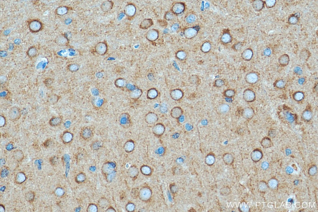 DNM1 Antibody in Immunohistochemistry (Paraffin) (IHC (P))