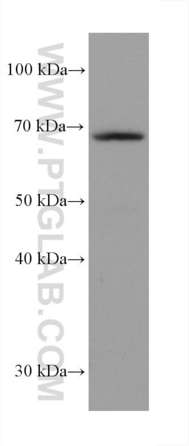 GMEB2 Antibody in Western Blot (WB)