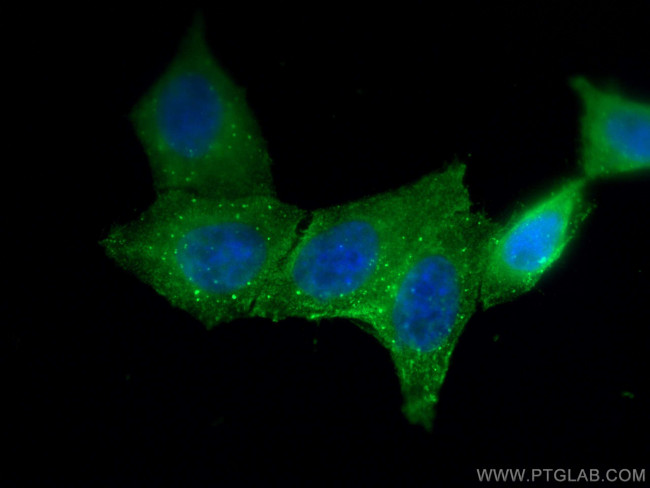 AGT Antibody in Immunocytochemistry (ICC/IF)
