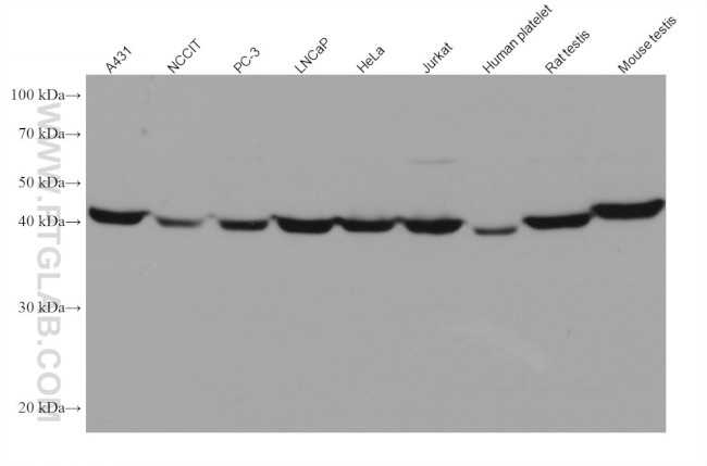 PGK1 Antibody in Western Blot (WB)