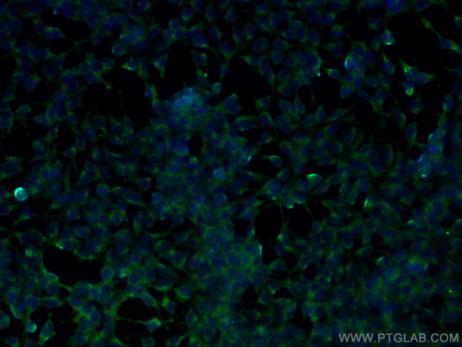 ALDH3A1 Antibody in Immunocytochemistry (ICC/IF)