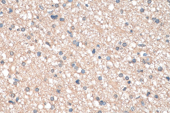 TMOD2 Antibody in Immunohistochemistry (Paraffin) (IHC (P))