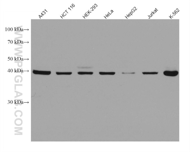 SMS Antibody in Western Blot (WB)