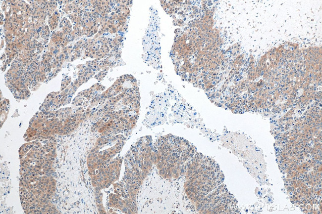 TTLL12 Antibody in Immunohistochemistry (Paraffin) (IHC (P))