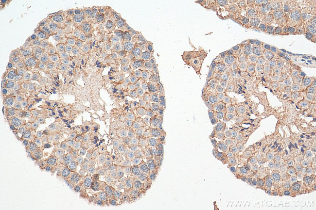 GAS2L1 Antibody in Immunohistochemistry (Paraffin) (IHC (P))